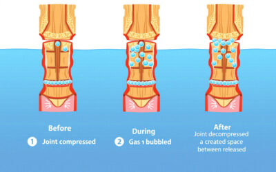 The Truth Behind the Pop: What That Cracking Sound Really Means in Chiropractic Adjustments